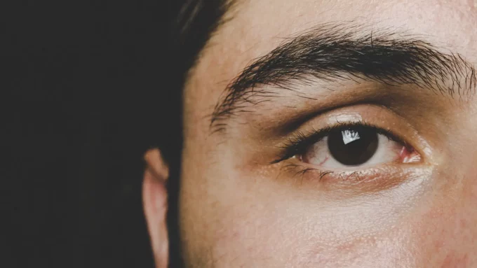 a closeup of a the right eye and side of face of a middle eastern man