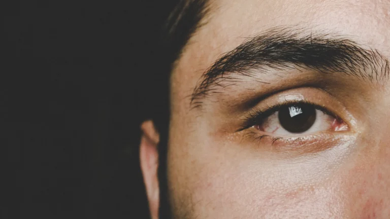 a closeup of the right eye and side of face of a middle eastern man
